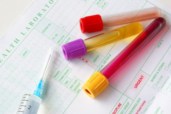 urinalysis lab report discussion
