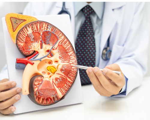 Kidney disease, Chronic kidney disease ckd, Doctor hold human model to treat and study in hospital.