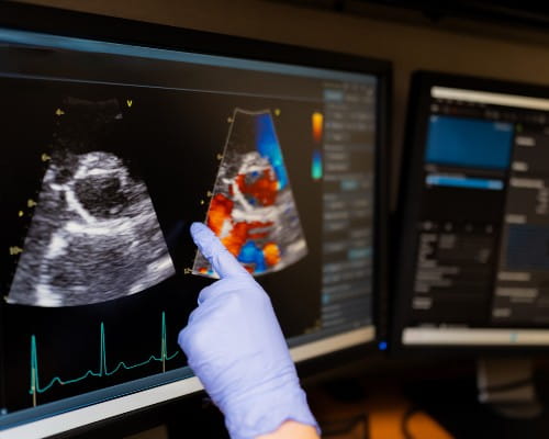 Doctor analyzing echocardiogram ultrasound on monitor 