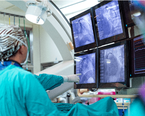 Interventional Radiology looking at x-ray image