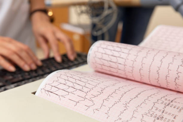 Electrocardiograms (called EKGs or ECGs)