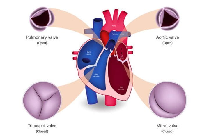 Understanding Valve Disorders