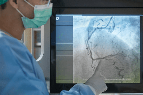 Coronary angiogram. X ray image procedure of heart disease.