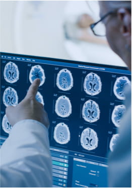 physicians reading brain cancer screening