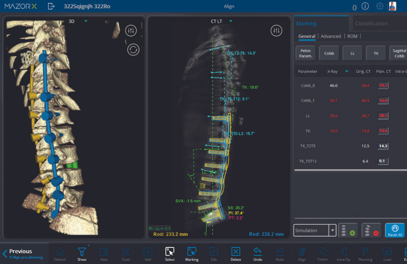 Spine banner