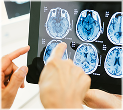 Doctors pointing at a brain scan