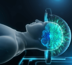 4D Animation of MRI  Brain Ultrasound 