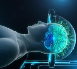 4D Animation of MRI  Brain Ultrasound 