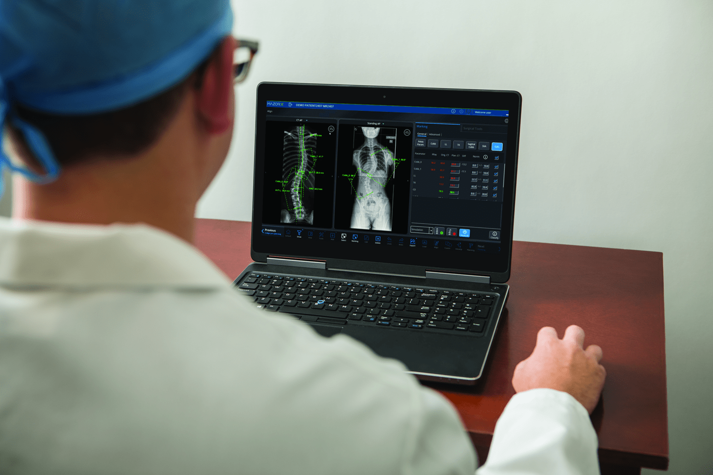 Robotic-Guided Spinal Surgery