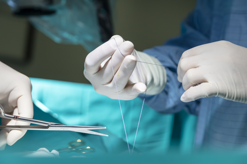 Doctor doing surgical stitches