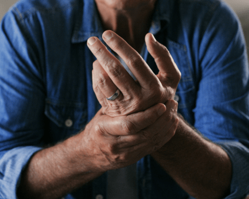 Arthritis Hand pain