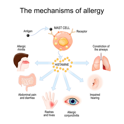 Mechanism of allergy. Mast cells and allergic reaction. Histamine. local immune responses. vector illustration