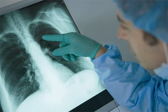 Pulmonologist looking at an X-ray