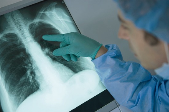 Pulmonologist looking at an X-ray