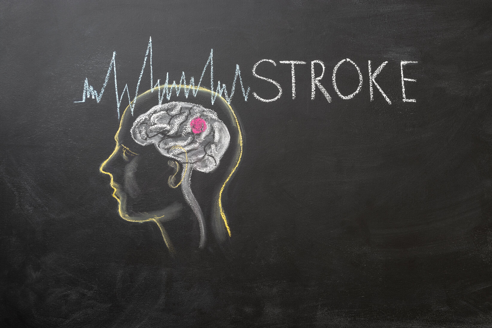 Hand drawing Brain with pulse symbol