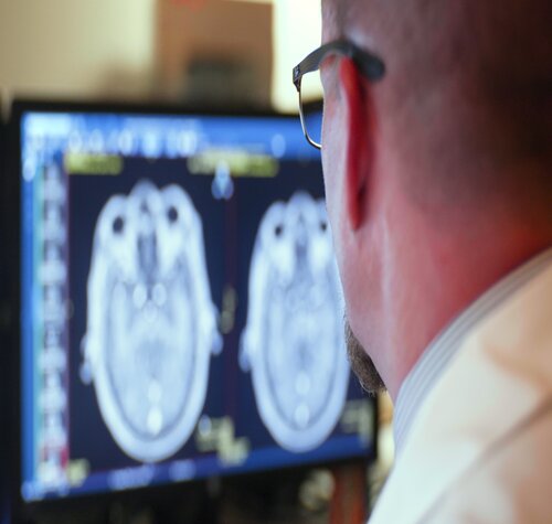 A doctor in glasses examines brain scans on a computer screen. The scans depict two detailed images of a human brain, conveying analysis and focus.