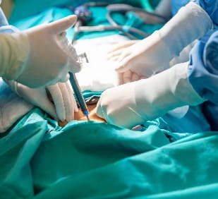 A surgeon in latex gloves and a blue uniform holds special medical instruments during a laparoscopic operation. 