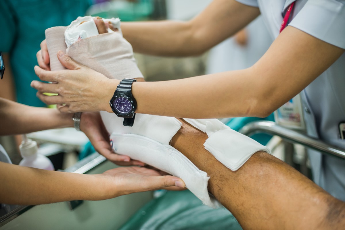 Patient with broken leg and splinted for treatment in the hospital