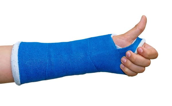 Arm in a cast