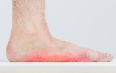 Man with signs of flatfoot foot