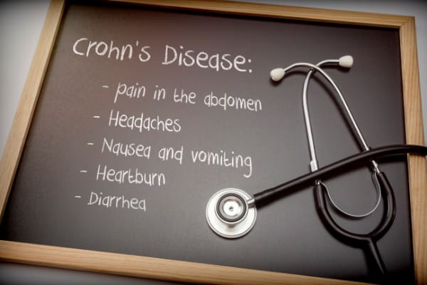 Crohn's disease can have these symptoms