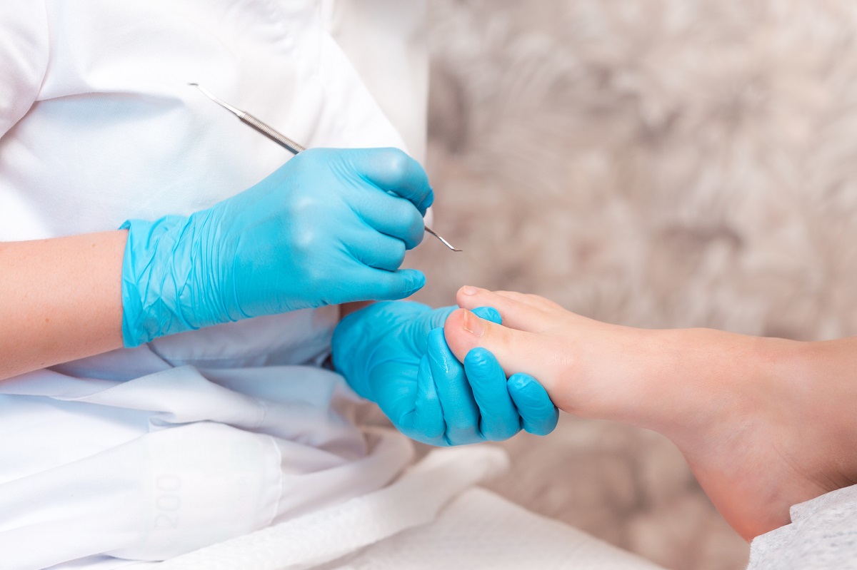 Ingrown Toenail