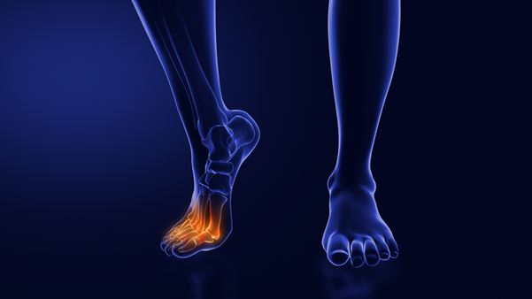 Ankle problems