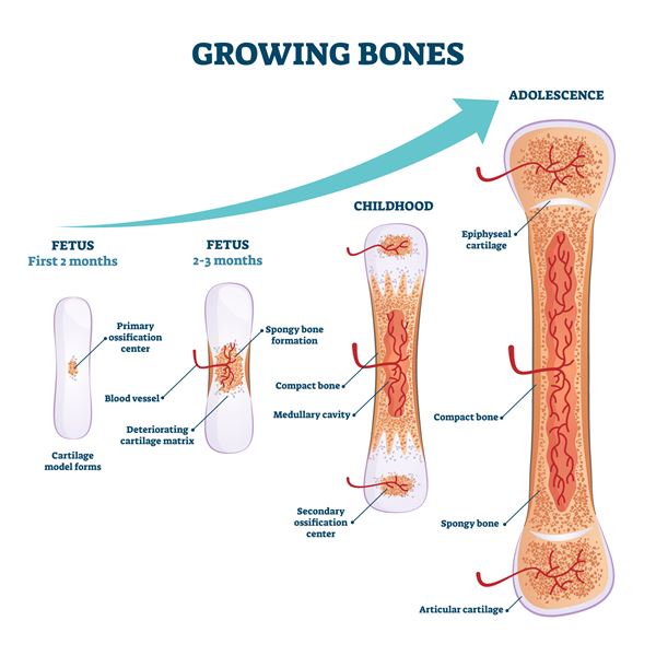 Growth pain