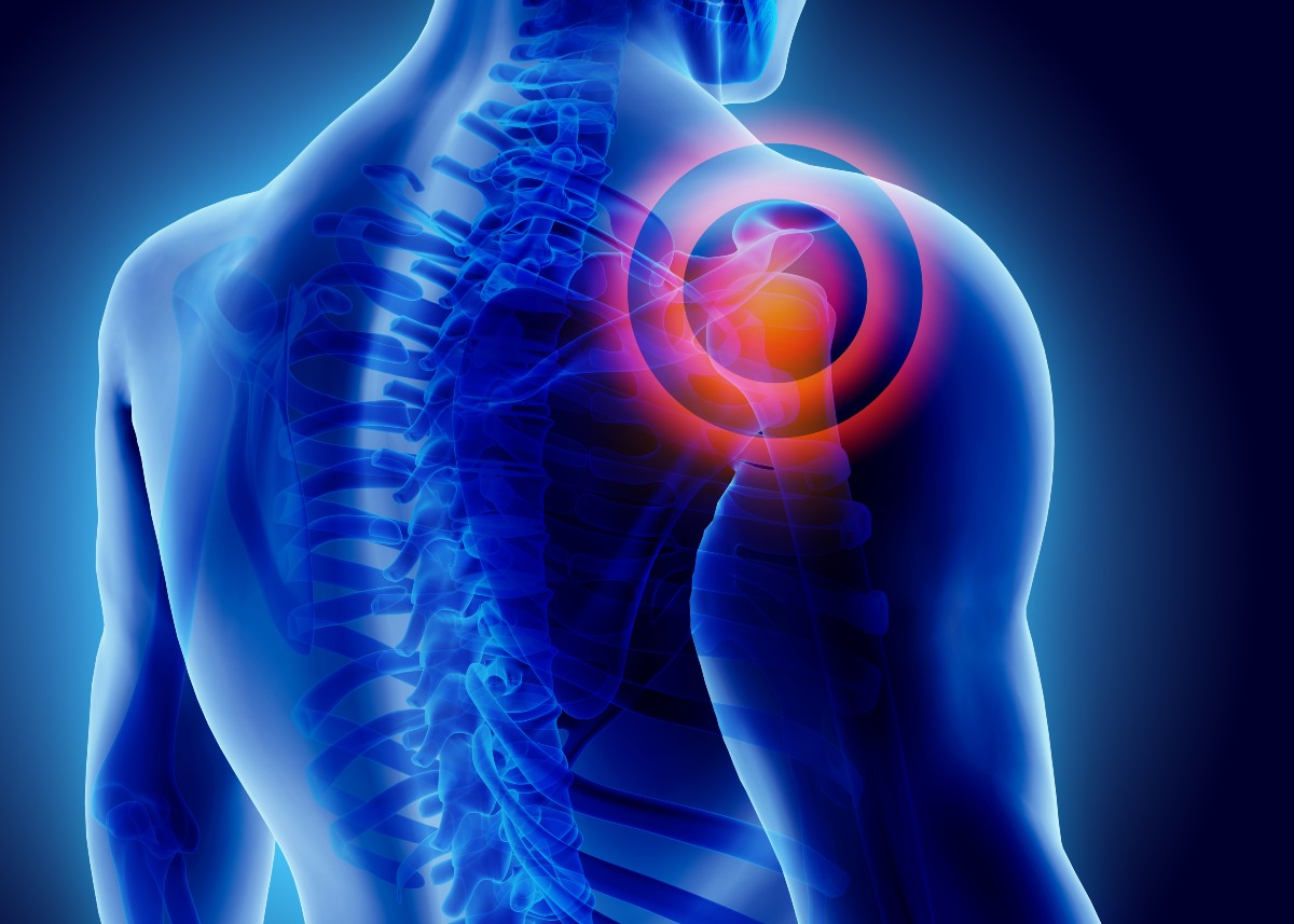 Rotator cuff