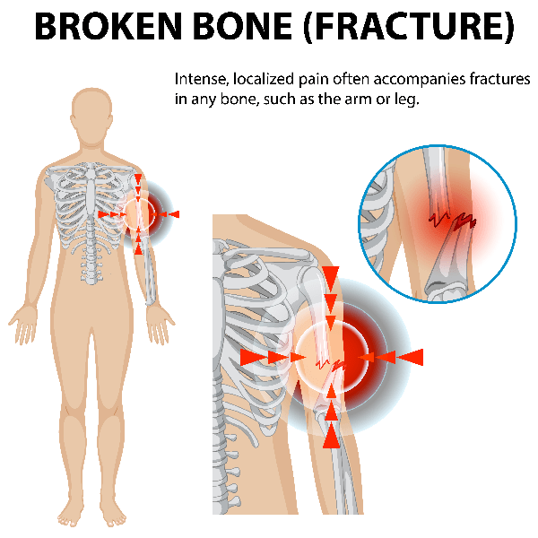 Shoulder and Upper Arm Pain Blog human skeleton