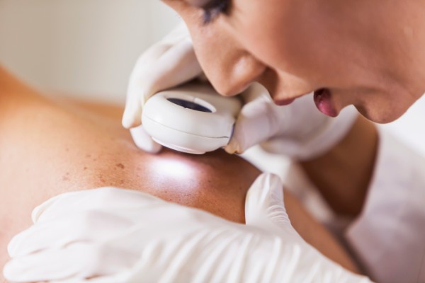 Dermatologist examining patient for signs of skin cancer