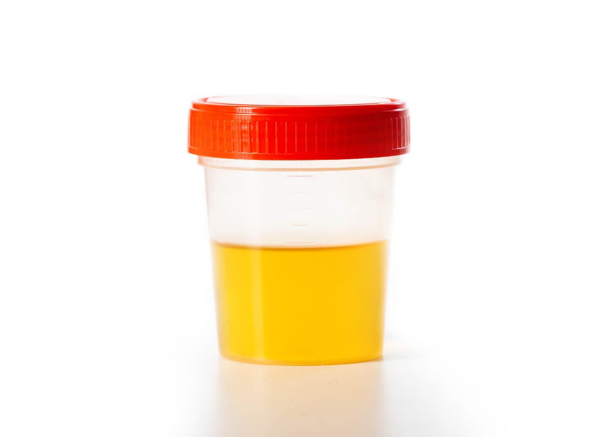 urine